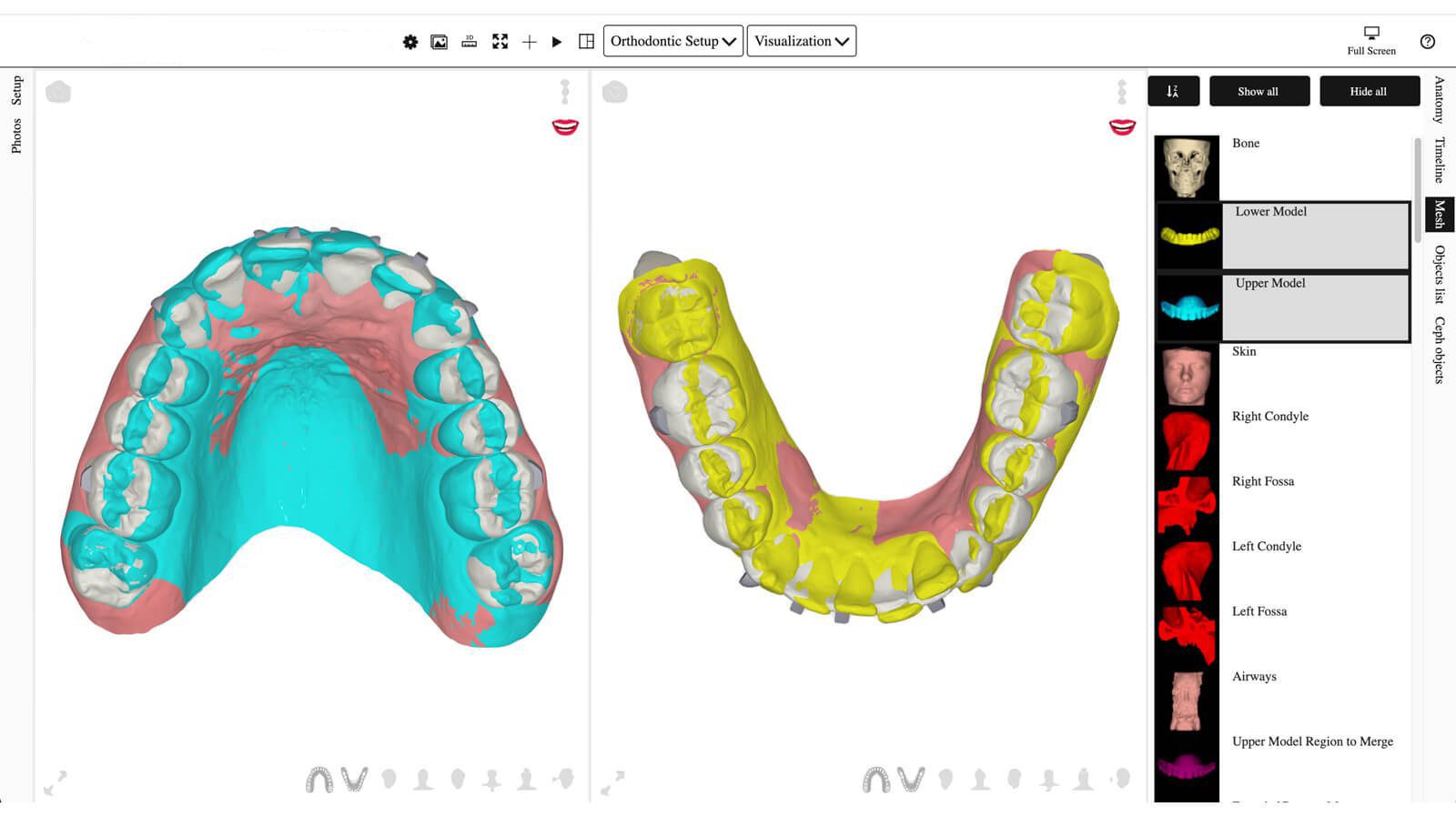 FAS Aligner System - FAS Stop and Go